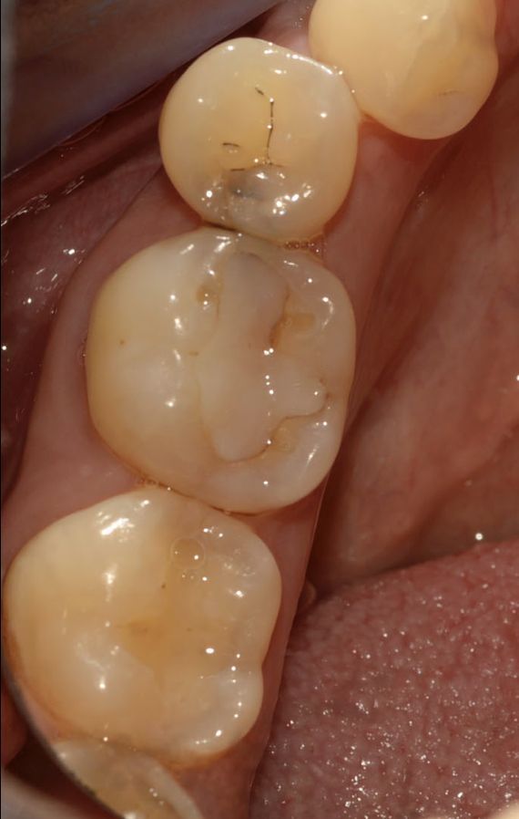 Prima del trattamento odontoiatrico